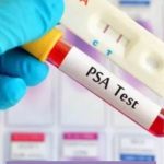 What Foods Can Help Improve Your PSA Foods-Can-Help-Improve-Your-PSA.jpg